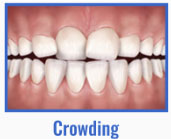Crowding